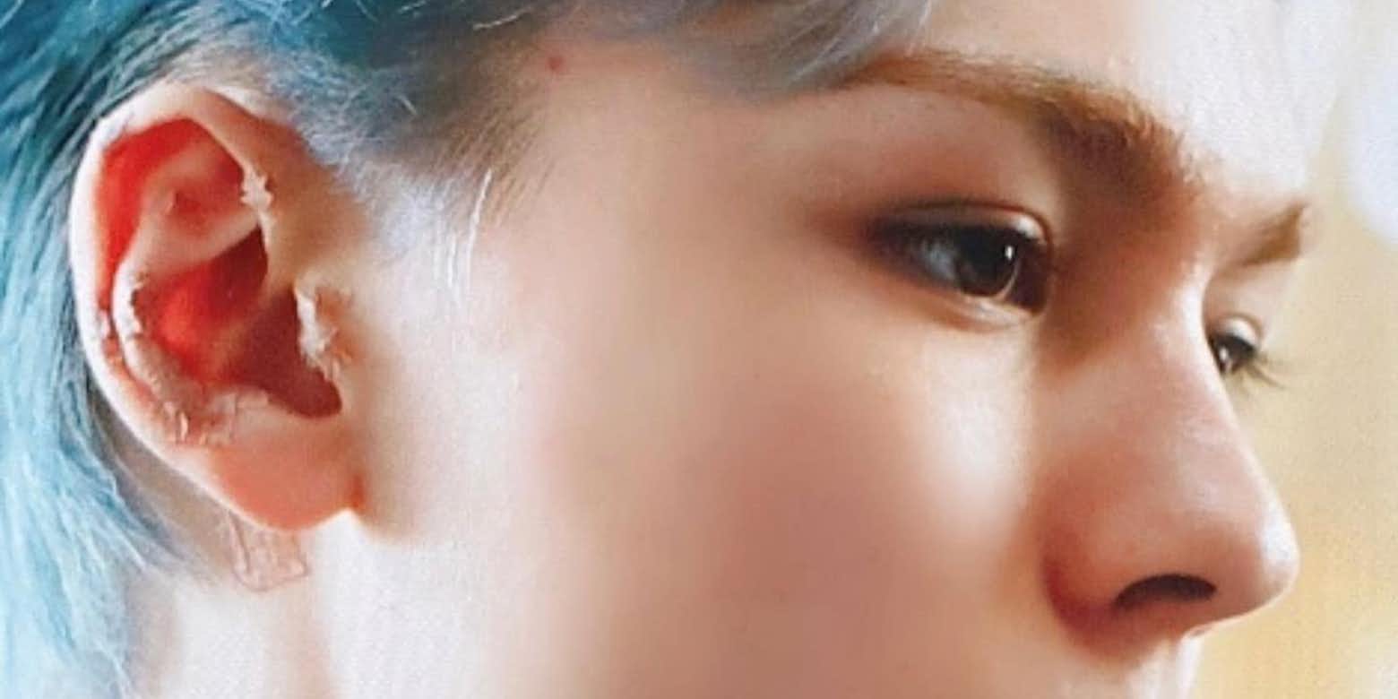 韓国アイドルもやっている耳ツボ いちょう街道整骨院のブログ 八王子の地域情報ポータルサイト はちなび