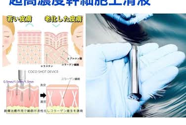 超高濃度ヒト幹細胞上清液　ダーマ鍼