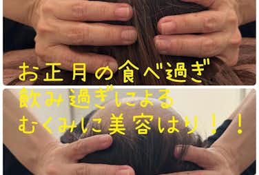 むくみ撃退美容鍼