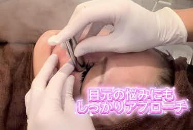 目元の悩みにも幹細胞ダーマ鍼