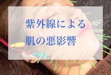 紫外線　美容鍼　幹細胞ダーマ鍼