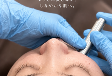 ゆらぎに美容鍼　幹細胞ダーマ鍼