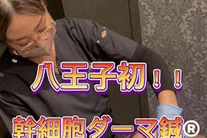 八王子初。新しい美容鍼始めませんか？