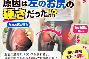 お尻の痛みのトリガーポイントは逆だった⁉️