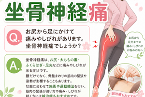 お尻や足に痛みや痺れがありますが坐骨神経痛ですか？