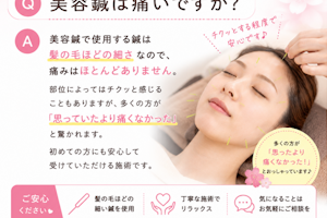 美容鍼は痛いですか？