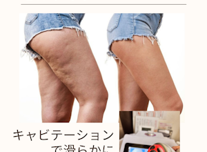 セルライトの正体は「血行不良」が原因の一つ　アワード八王子