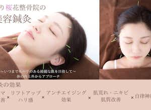 お顔の疲れは美容鍼で解消！