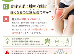 膝の内側の痛みは鵞足炎ですか？
