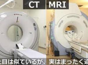 MRIとCTの違いは？