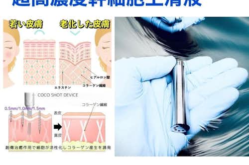超高濃度ヒト幹細胞上清液　ダーマ鍼