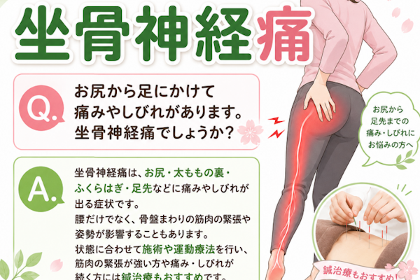 お尻や足に痛みや痺れがありますが坐骨神経痛ですか？