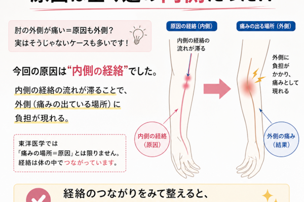 肘の外側の痛みの原因は内側