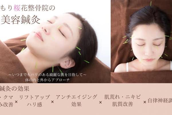 お顔の疲れは美容鍼で解消！