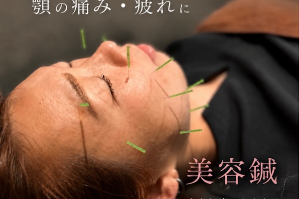 顎の食いしばりには美容鍼で治療